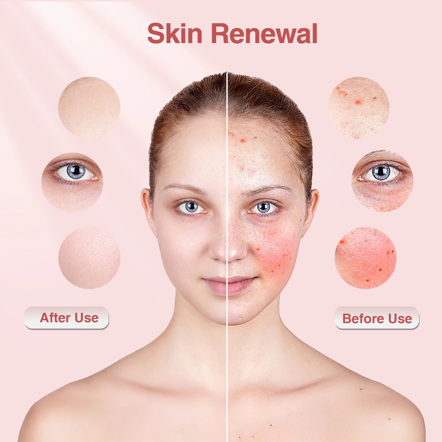 Red Light Therapy Photon Mask